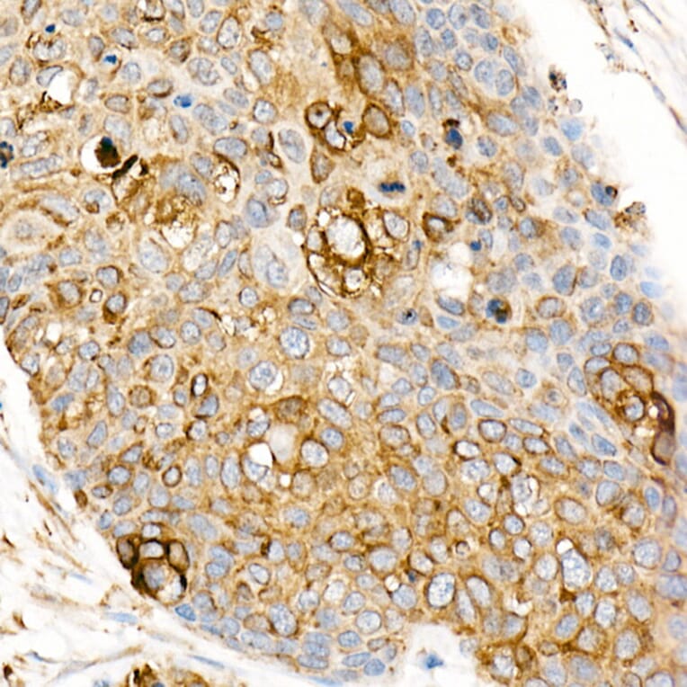Immunohistochemistry - Anti-Fas Ligand Antibody (A11128) - Antibodies.com