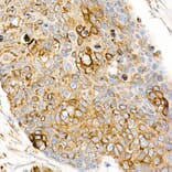 Immunohistochemistry - Anti-Fas Ligand Antibody (A11128) - Antibodies.com