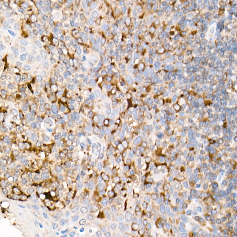 Immunohistochemistry - Anti-Fas Ligand Antibody (A11128) - Antibodies.com