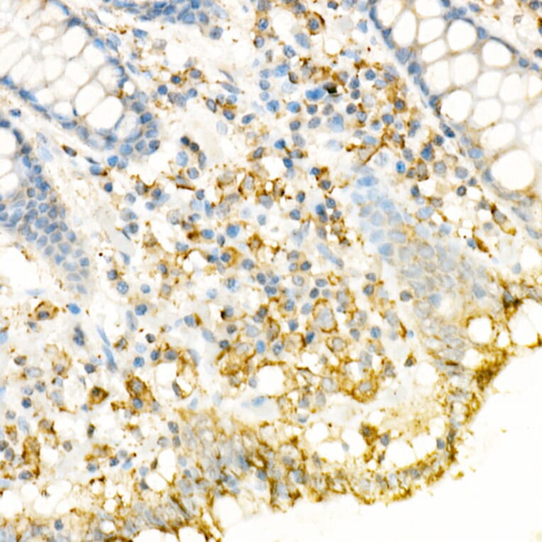 Immunohistochemistry - Anti-Fas Ligand Antibody (A11128) - Antibodies.com