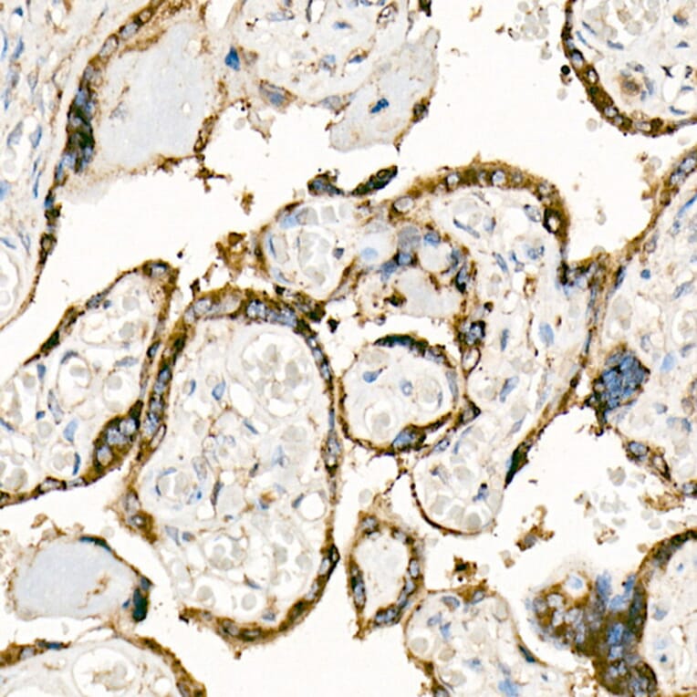 Immunohistochemistry - Anti-Fas Ligand Antibody (A11128) - Antibodies.com
