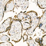 Immunohistochemistry - Anti-Fas Ligand Antibody (A11128) - Antibodies.com