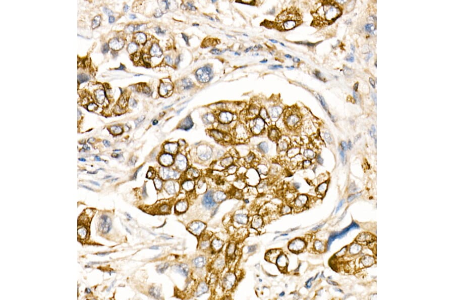 Immunohistochemistry - Anti-Fas Ligand Antibody (A11128) - Antibodies.com