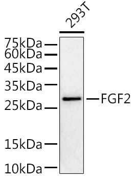 Western blot analysis of extracts of various cell lines, using Anti-FGF2 Antibody (A0235) at 1:1,000 dilution.
Secondary antibody: Goat Anti-Rabbit IgG (H+L) (HRP) (AS014) at 1:10,000 dilution.
Lysates / proteins: 25µg per lane.
Blocking buffer: 3% non-fat dry milk in TBST.
Detection: ECL Enhanced Kit (RM00021).
Exposure time: 30s.