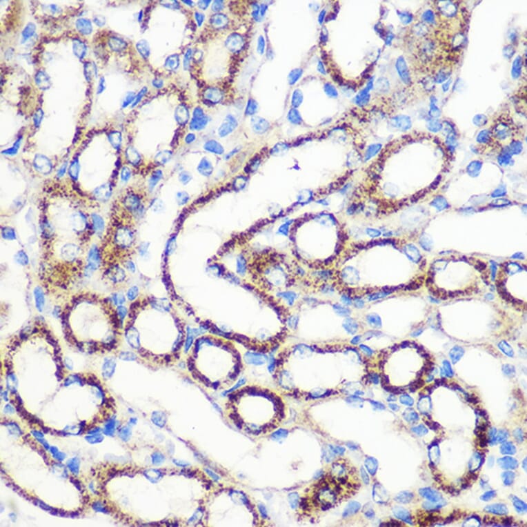 Immunohistochemistry - Anti-FGF2 Antibody (A11129) - Antibodies.com