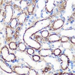 Immunohistochemistry - Anti-FGF2 Antibody (A11129) - Antibodies.com