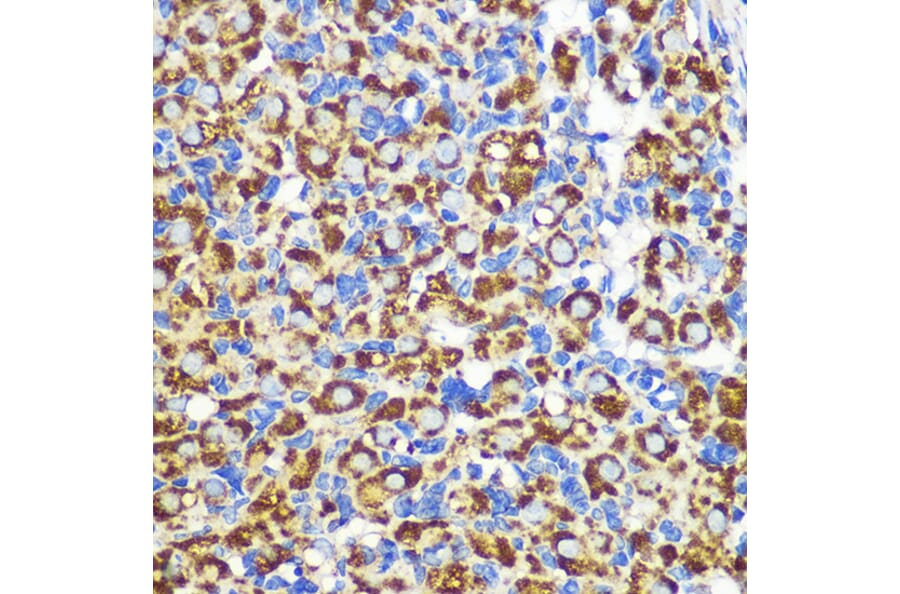 Immunohistochemistry - Anti-FGF2 Antibody (A11129) - Antibodies.com
