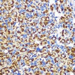 Immunohistochemistry - Anti-FGF2 Antibody (A11129) - Antibodies.com