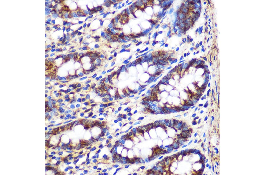 Immunohistochemistry - Anti-FGF2 Antibody (A11129) - Antibodies.com
