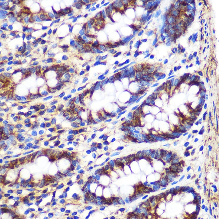 Immunohistochemistry - Anti-FGF2 Antibody (A11129) - Antibodies.com