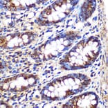 Immunohistochemistry - Anti-FGF2 Antibody (A11129) - Antibodies.com