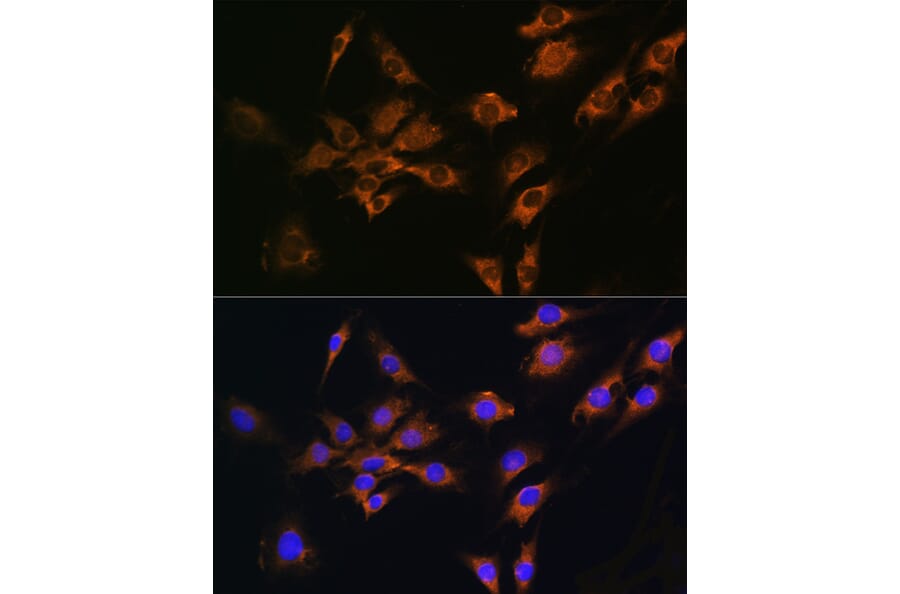 Immunofluorescence - Anti-FGF2 Antibody (A11129) - Antibodies.com
