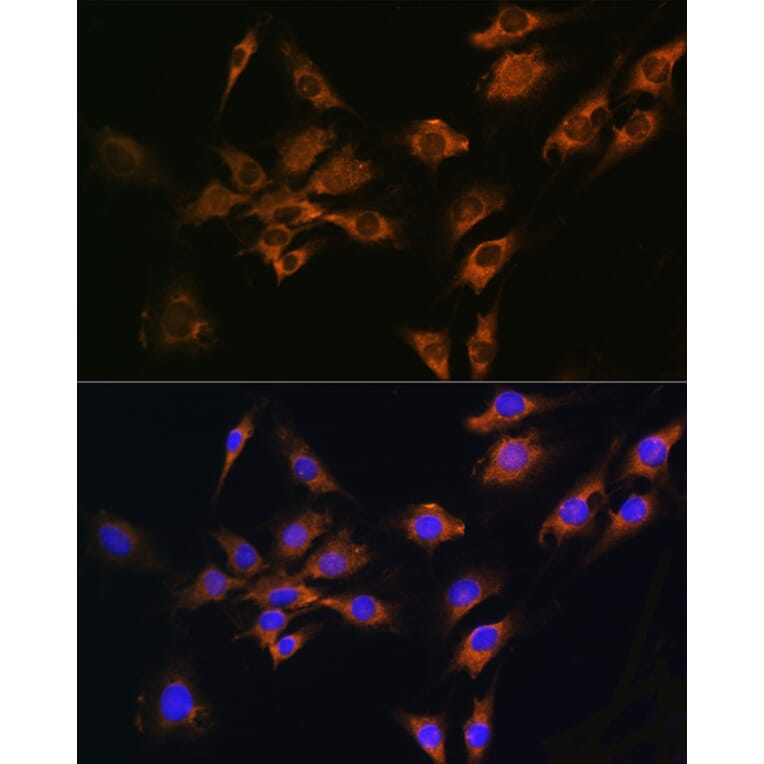 Immunofluorescence - Anti-FGF2 Antibody (A11129) - Antibodies.com