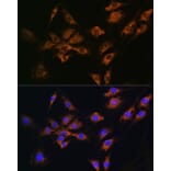 Immunofluorescence - Anti-FGF2 Antibody (A11129) - Antibodies.com
