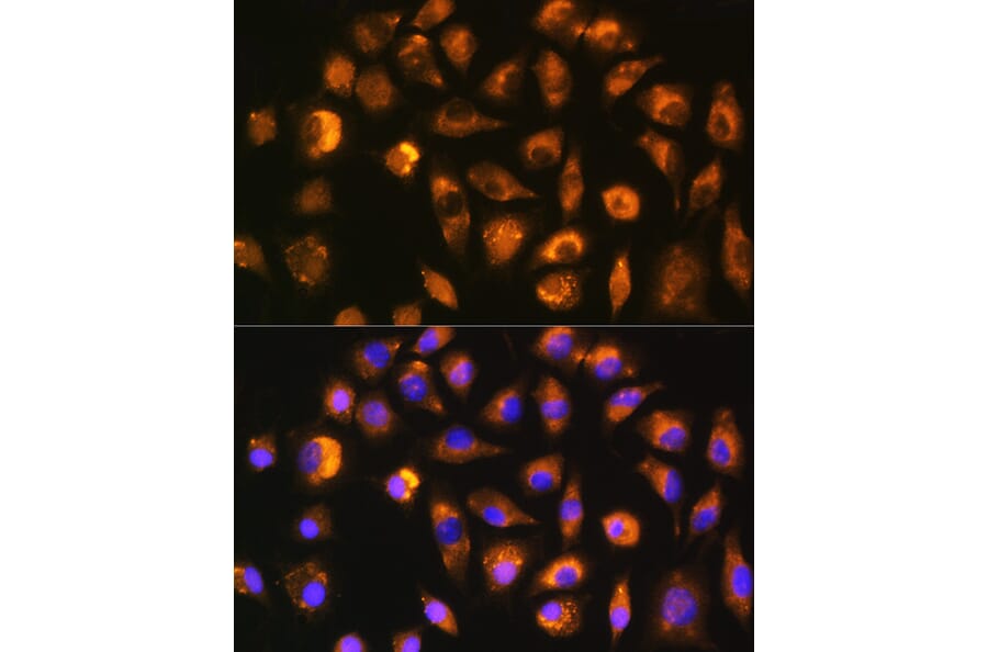Immunofluorescence - Anti-FGF2 Antibody (A11129) - Antibodies.com