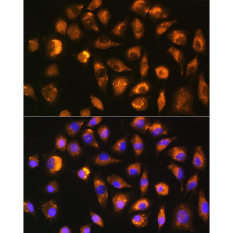 Immunofluorescence - Anti-FGF2 Antibody (A11129) - Antibodies.com
