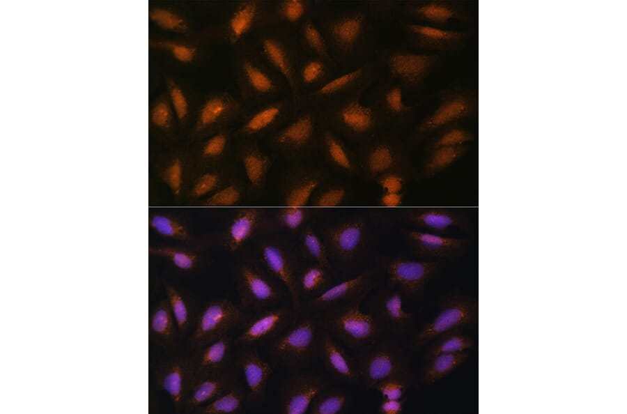 Immunofluorescence - Anti-FGF2 Antibody (A11129) - Antibodies.com