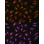 Immunofluorescence - Anti-FGF2 Antibody (A11129) - Antibodies.com