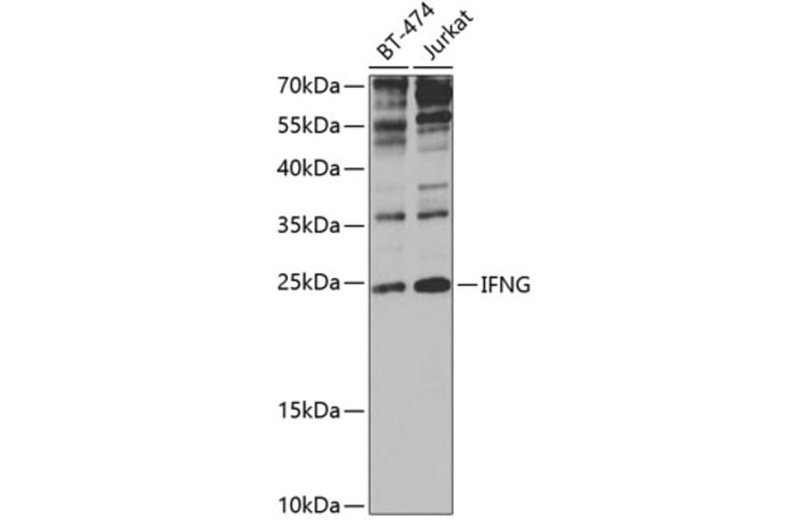 Western Blot - Anti-Interferon gamma Antibody (A11130) - Antibodies.com