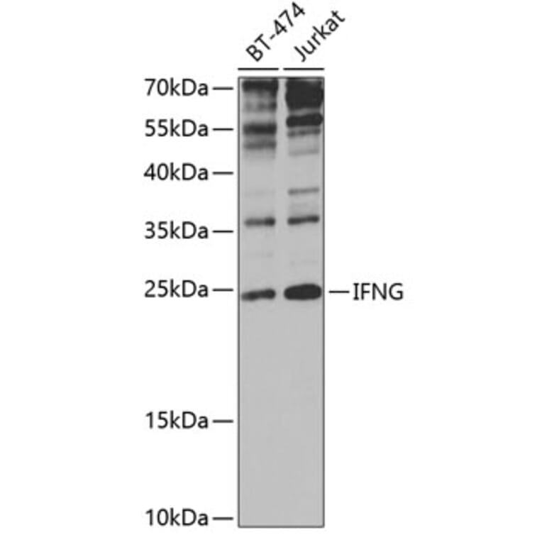 Western Blot - Anti-Interferon gamma Antibody (A11130) - Antibodies.com