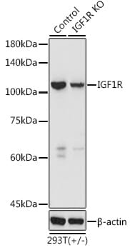 Western blot analysis of extracts of various cell lines, using Anti-IGF1R Antibody (A0243) at 1:1,000 dilution.
Secondary antibody: Goat Anti-Rabbit IgG (H+L) (HRP) (AS014) at 1:10,000 dilution.
Lysates / proteins: 25µg per lane.
Blocking buffer: 3% non-fat dry milk in TBST.
Detection: ECL Enhanced Kit (RM00021).
Exposure time: 90s.