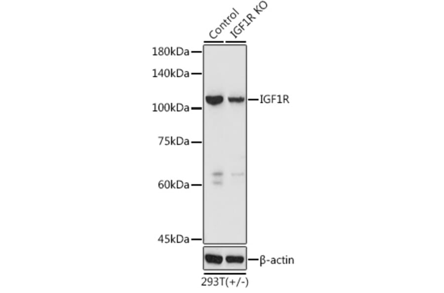 Western Blot - Anti-IGF1 Receptor Antibody (A11131) - Antibodies.com