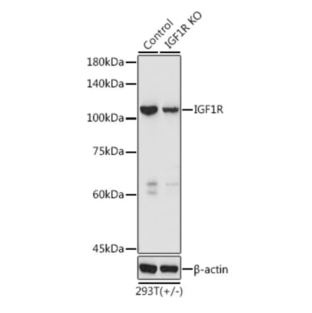 Western Blot - Anti-IGF1 Receptor Antibody (A11131) - Antibodies.com