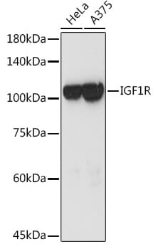 Immunohistochemistry of paraffin-embedded mouse liver using Anti-IGF1R Antibody (A0243) at dilution of 1:100 (40x lens).