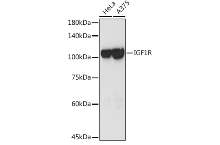 Western Blot - Anti-IGF1 Receptor Antibody (A11131) - Antibodies.com