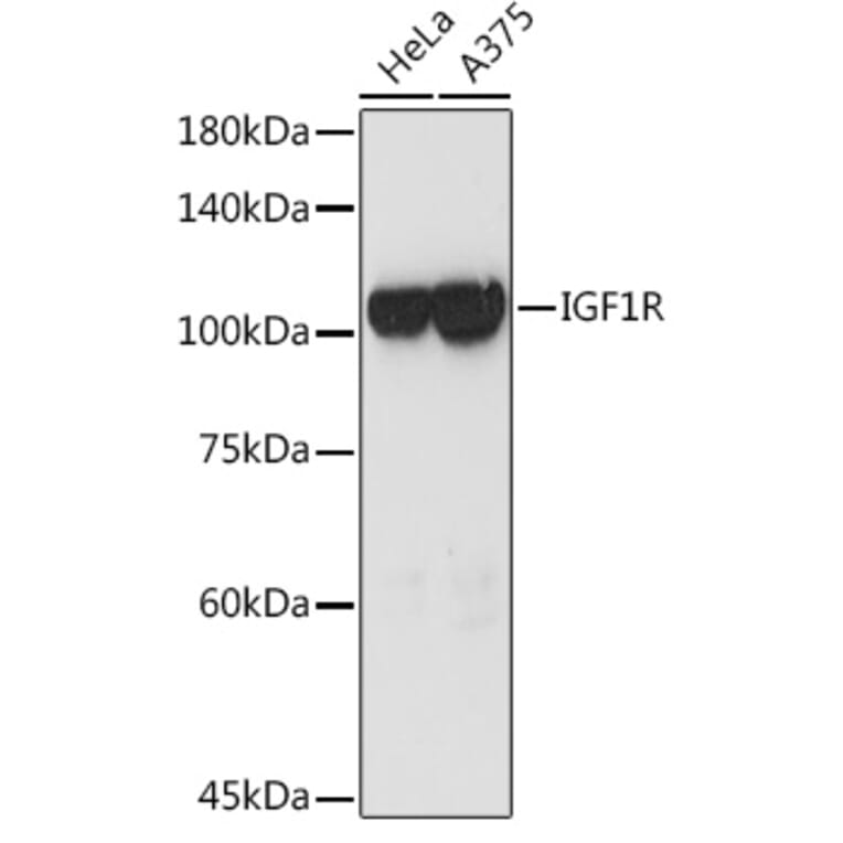 Western Blot - Anti-IGF1 Receptor Antibody (A11131) - Antibodies.com
