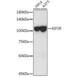 Western Blot - Anti-IGF1 Receptor Antibody (A11131) - Antibodies.com