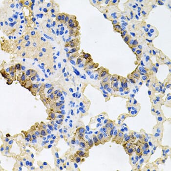 Immunohistochemistry of paraffin-embedded mouse lung using Anti-IGF1R Antibody (A0243) at dilution of 1:100 (40x lens).