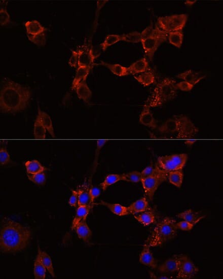 Immunofluorescence analysis of NIH/3T3 cells using Anti-IGF1R Antibody (A0243) at dilution of 1:100 (40x lens). Blue: DAPI for nuclear staining.