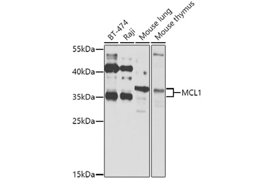 Western Blot - Anti-MCL1 Antibody (A11132) - Antibodies.com