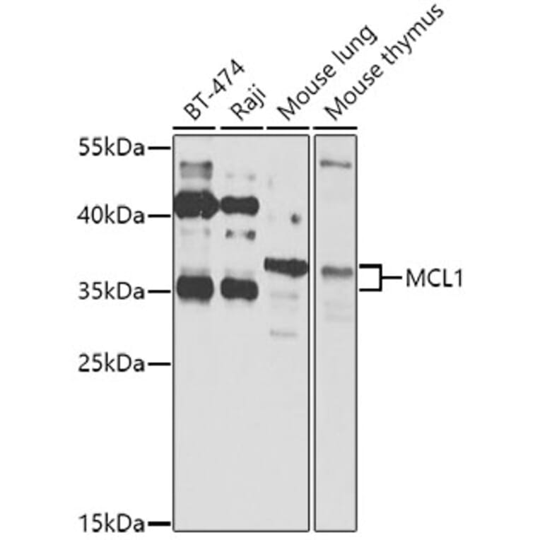 Western Blot - Anti-MCL1 Antibody (A11132) - Antibodies.com
