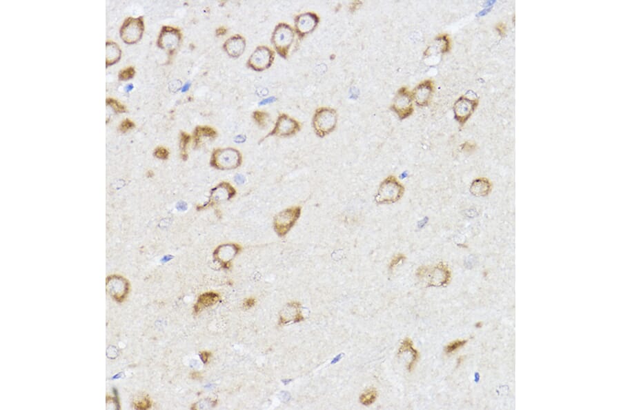 Immunohistochemistry - Anti-MCL1 Antibody (A11132) - Antibodies.com
