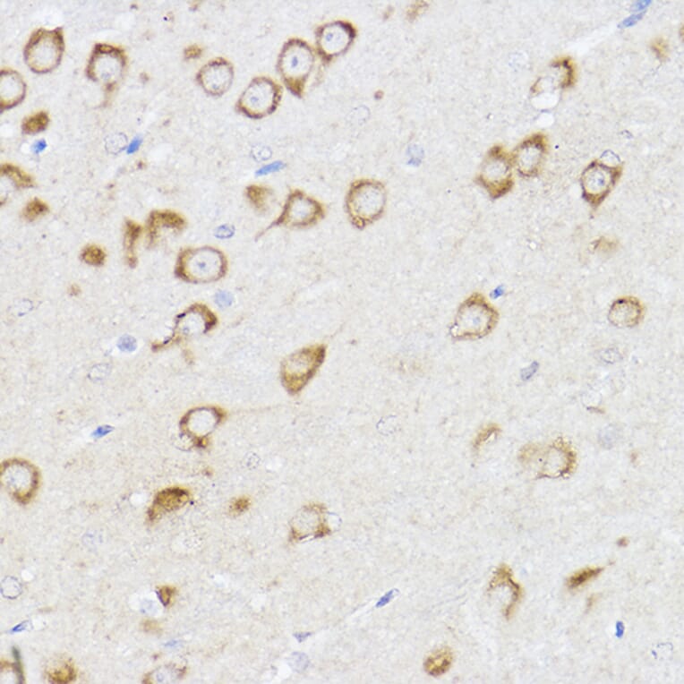 Immunohistochemistry - Anti-MCL1 Antibody (A11132) - Antibodies.com