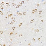 Immunohistochemistry - Anti-MCL1 Antibody (A11132) - Antibodies.com