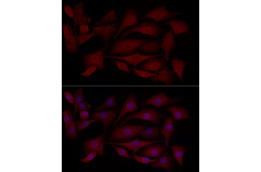 Immunofluorescence - Anti-MCL1 Antibody (A11132) - Antibodies.com