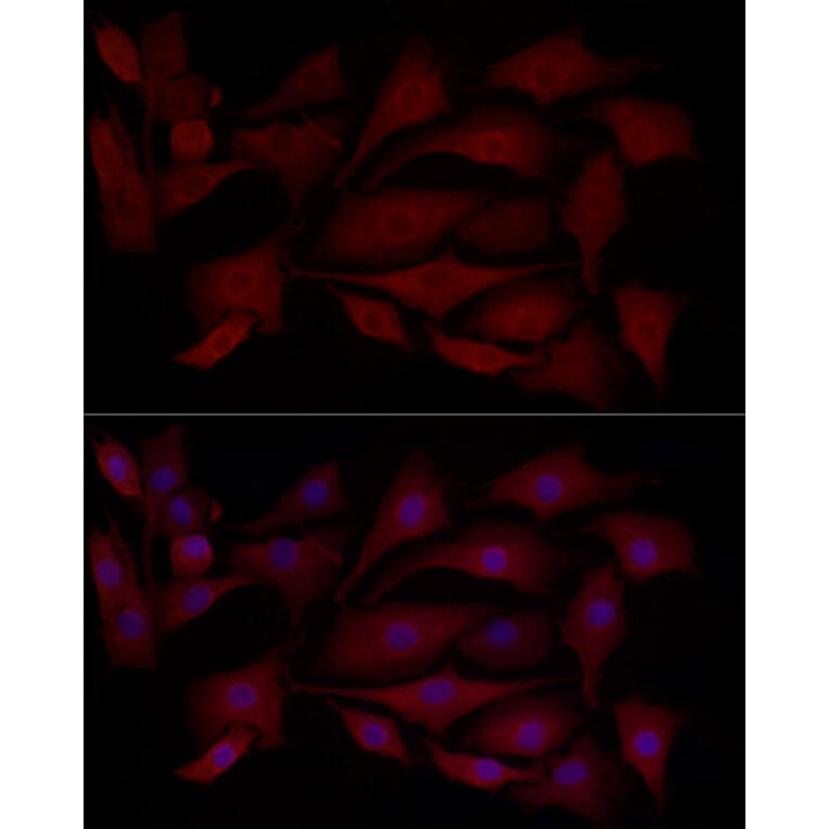 Immunofluorescence - Anti-MCL1 Antibody (A11132) - Antibodies.com