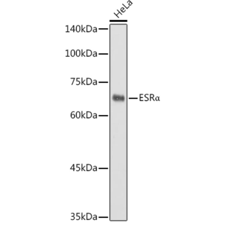 Western Blot - Anti-Estrogen Receptor alpha Antibody (A11135) - Antibodies.com