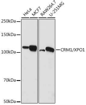 Western blot analysis of extracts of various cell lines, using Anti-XPO1 Antibody (A0299) at 1:1,000 dilution.
Secondary antibody: Goat Anti-Rabbit IgG (H+L) (HRP) (AS014) at 1:10,000 dilution.
Lysates / proteins: 25µg per lane.
Blocking buffer: 3% non-fat dry milk in TBST.
Detection: ECL Enhanced Kit (RM00021).
Exposure time: 1s.