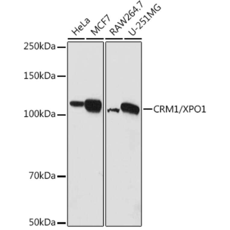 Western Blot - Anti-CRM1 Antibody (A11136) - Antibodies.com
