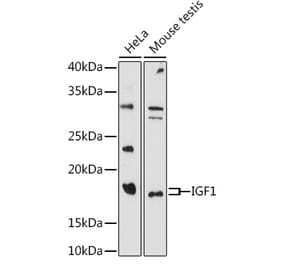 Western Blot - Anti-IGF1 Antibody (A11137) - Antibodies.com