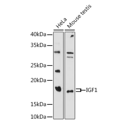 Western Blot - Anti-IGF1 Antibody (A11137) - Antibodies.com