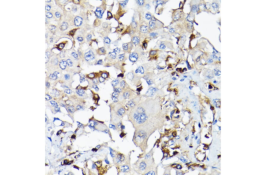 Immunohistochemistry - Anti-IGF1 Antibody (A11137) - Antibodies.com
