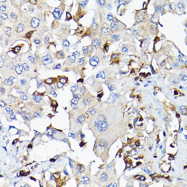 Immunohistochemistry - Anti-IGF1 Antibody (A11137) - Antibodies.com