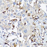 Immunohistochemistry - Anti-IGF1 Antibody (A11137) - Antibodies.com