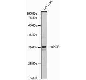 Western Blot - Anti-Apolipoprotein E Antibody (A11138) - Antibodies.com