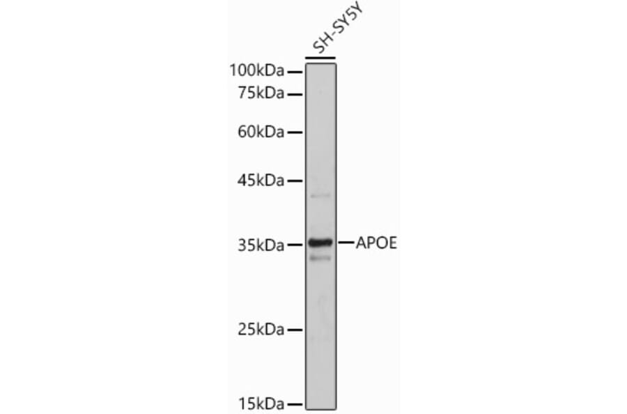 Western Blot - Anti-Apolipoprotein E Antibody (A11138) - Antibodies.com